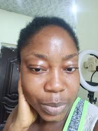 How to get rid of dark spots, especially