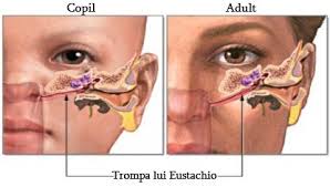 Otita Durerea De Ureche La Copii Ear Infection Remedy Ear Tubes Eustachian Tube Dysfunction
