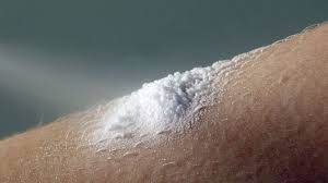 Unser testerteam hat eine große auswahl an produzenten unter die weiße lupe genommen und wir zeigen unseren lesern hier die. Enstilar Was Ist Das Und Wie Wird Es Angewendet Salben Cremes Und Gels Psoriasis Netz
