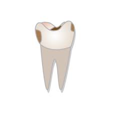 Oral Health Before During After Pregnancy Newmouth