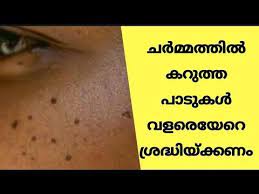 Be Careful Of Dark Spots On The Skin Malayalam Rock Bull Media Dark Spots On Skin Black Spots On Face Dark Spots
