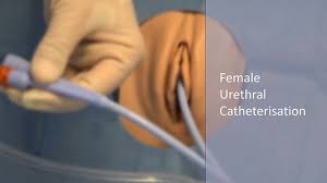 Image result for Urethral Catheterization
