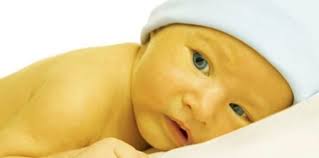 Penyakit kuning pada bayi (jaundice) atau yang dikenal juga dengan istilah bayi kuning, adalah kondisi perubahan warna pada kulit dan mata bayi baru lahir hingga terlihat kekuningan. Penyakit Kuning Pada Bayi Inilah 15 Fakta Yang Harus Parents Ketahui