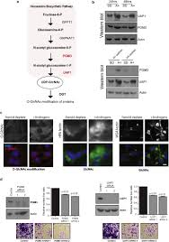 Bon.live android 2.6.0 apk download and install. Glycosylation Is An Androgen Regulated Process Essential For Prostate Cancer Cell Viability Ebiomedicine
