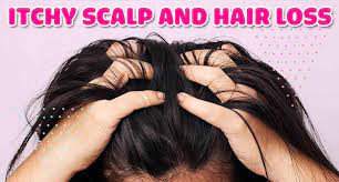 Once conditions have improved, the hair will most likely grow back. Myth Busting Itchy Scalp And Hair Loss How Are They Related