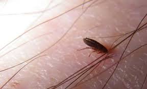 Cat Fleas On Humans Including On Hair Treatments Pets Mentor