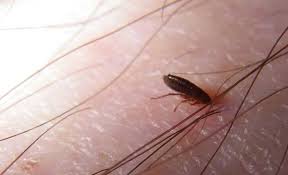 They are smaller than cat fleas but the allergic reaction is very strong. Cat Fleas On Humans Including On Hair Treatments Pets Mentor