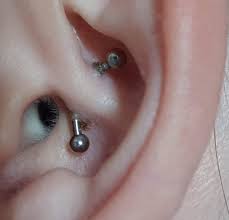 Is This Normal For A 10 Day Old Daith Piercing Piercing