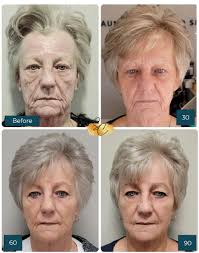 The 2023 NeoGen Plasma Global Excellence Award