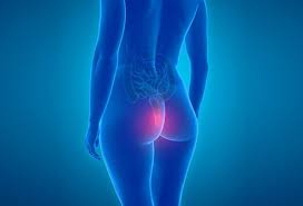 Hemorrhoids might be uncomfortable, but fortunately, simple hemorrhoid treatment measures are quite effective. How To Get Rid Of Hemorrhoids Types Causes And Treatments