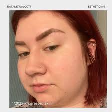 Natalie Walcott Esthetics (@nwalcottskin) • Instagram photos and videos