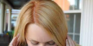 Coloring your hair is very easy but when it is about to remove hair color then it can be a difficult job. The 7 Most Common Hair Color Mistakes And How To Fix Them