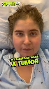 My face looked like a moon