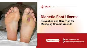 Image result for toe black diabetes