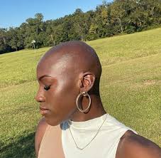 Years after struggling with alocepia, Taylor finds her new smile