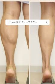 がんばっても細くならないししゃも足を細くする方法は ふくらはぎ 筋肉 落とす ふくらはぎ 筋肉 落とす