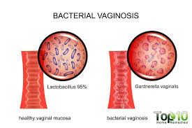 Pin On Vaginal Health