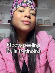 Efecto peeling de la Tretinoina: Resultados y Beneficios