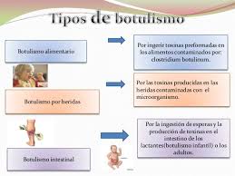 El botulismo es una intoxicación que se genera mayoritariamente por la ingesta de alimentos envasados en malas condiciones. Botulismo Clostridium Botulinum Curiosidad Gastronomica