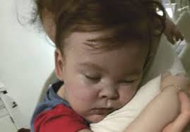 Mor Alfie Evans, el nadó enmig d'una batalla legal al Regne Unit