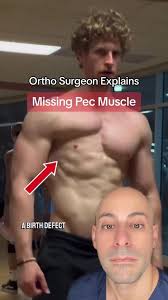 Pec Muscle Imbalance