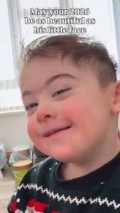 How I love his handsome face… This is the beautiful face of a person with  Down Syndrome & I think it's the most beautiful face in the world.  #downsyndromeawareness #downsyndrome #dscommunity  #positiveaboutdownsyndrome #