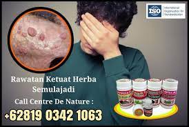 Minyak kelapa ternyata salah satu cara menghilangkan uban yang ampuh yaitu dengan cara dicampurkan dengan air jeruk nipis. Cara Hilangkan Ketuat Kelamin Berkesan Terbaik Lokasi De Nature Di Malaysia Sipilis Kencing Sakit Kencing Nanah Kelamin Gatal Kelamin Bengkak