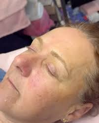 this brow tattoo transformation 😍 swipe for the before >>>