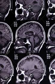 Why mrt moral reasoning is how people make decisions about what they should or should not do in a given situation. Mrt Bild Des Gehirns Fur Die Diagnose Lizenzfreie Fotos Bilder Und Stock Fotografie Image 22705278