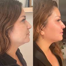 Ritual Skin And Soul