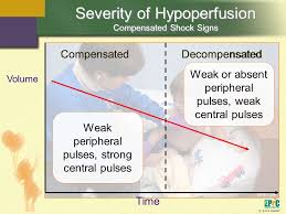 As verbs the difference between compensate and decompensate is that compensate is to pay or reward someone in exchange for work done or some other consideration while decompensate is. Hypoperfusion And Shock Ppt Video Online Download