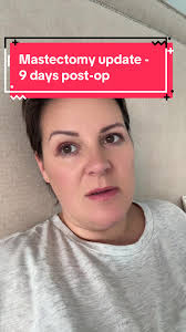 Dcis Mastectomy Grade 3 Schedule Time