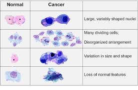 Characteristics Of Cancer Cells Png 1442 947 Cancer Prevention Cancer Cell Cancer