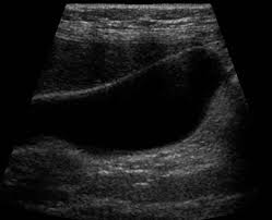 Ponemos a tu disposición una amplia gama de estudios de ultrasonografía diagnóstica realizados por profesionales algunos estudios con los que contamos son: Ultrasonido Ecografia