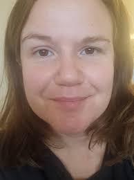 Wonky Eyes and Facial Asymmetry