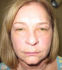 Functional Procedures Los Angeles