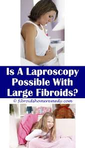 Pin On Uterine Fibroid Removal