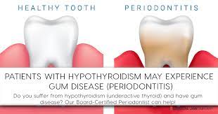 Coastal Jaw Surgery If You Are Suffering From Gum Disease Periodontitis Our Board Certified Periodontist Dr Lindsey Pikos Rosati Can Help Dr Rosati Offers Periodontal Services In Our Palm Harbor Office And