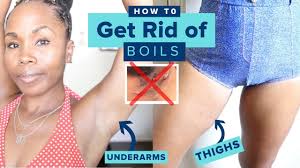 As you can see how does this benefit? How To Get Rid Of Boils In Armpits Legs Thighs My Hidradenitis Body Skincare Routine Treatment Youtube
