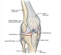 The femoral condyle allograft has been used for resurfacing cartilage defects with mature hyaline cartilage for several decades, with very high success rates. Treatment With Dr Farr Orthoindy Surgeon