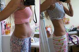 Home Remedies To Shrinking Your Tummy After A Csection - Twinmom