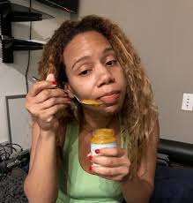 Communities>dental health>swollen cheek 2 weeks after 1 wisdom tooth extraction? Wisdom Teeth Removal Swelling Teethwalls