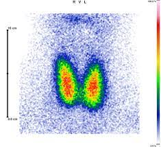 Unter einer hypothyreose versteht man eine mangelnde versorgung des körpers mit den schilddrüsenhormonen. Nuklearmedizin Radiologische Praxis Bitburg