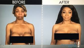 A where are they now of flavor of love contestants. Botched Tiffany Pollard F2a59788026706bc Jpg Vevmo