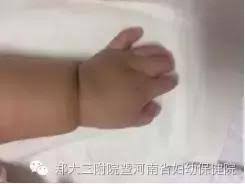 Search for text in url. é´¨æŽŒ å¥³å­© ç©¶ç«Ÿæ˜¯ä»€éº¼ç—… å¤§å¤«ç«Ÿç„¶èªªæ²'æ³•é é˜² æ¯æ—¥é ­æ¢
