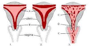 Resultado de imagen para HISTEROSCOPIA HEMORRAGIA UTERINA ANORMAL