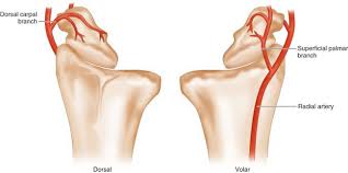 The dominant vascular pedicle to the medial femoral condyle flap is the descending branch of the geniculate artery, but in up to 23% of patients, the superomedial genicular artery emerging from the popliteal fossa may be dominant. 70 Medial Femoral Condyle Vascularized Bone Flap For Scaphoid Nonunion Clinical Gate