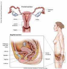 Symptoms of uterine cancer and uterine fibroids that are similar include pain or feeling of fullness in the abdomen or frequent urination. View All Pages Cancer Net