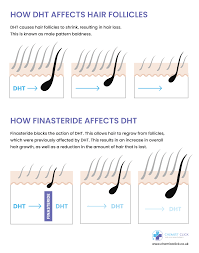 Fighting hair loss with finasteride. Does Finasteride Propecia Actually Work Chemist Click Uk