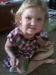 What is a suitable title for the image?